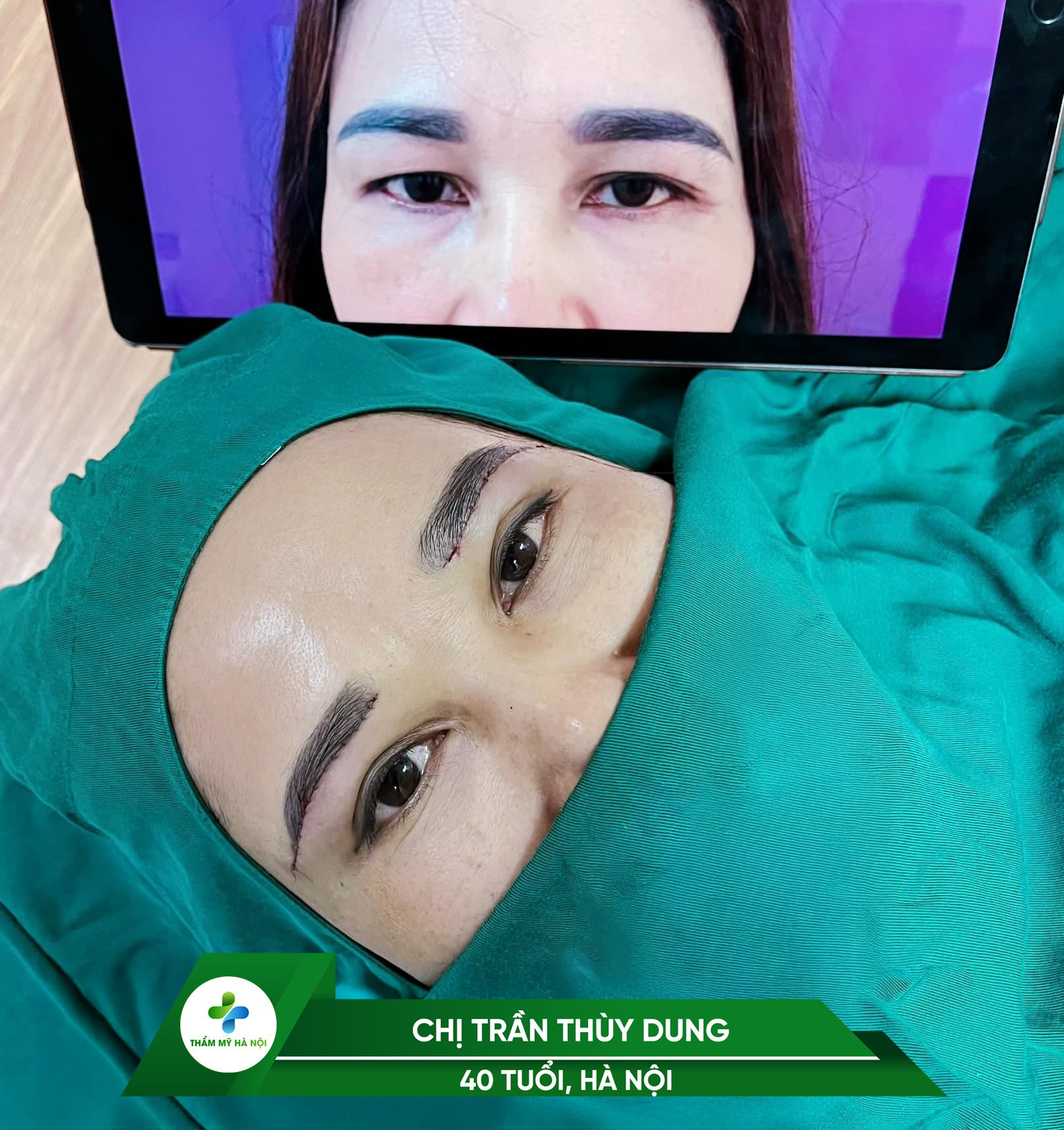 Khách hàng Thùy Dung