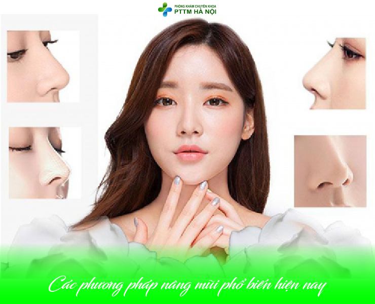 Các phương pháp nâng mũi phổ biến hiện nay