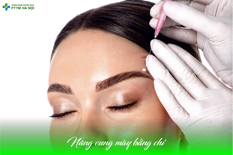 Nâng Cung Mày Bằng Chỉ