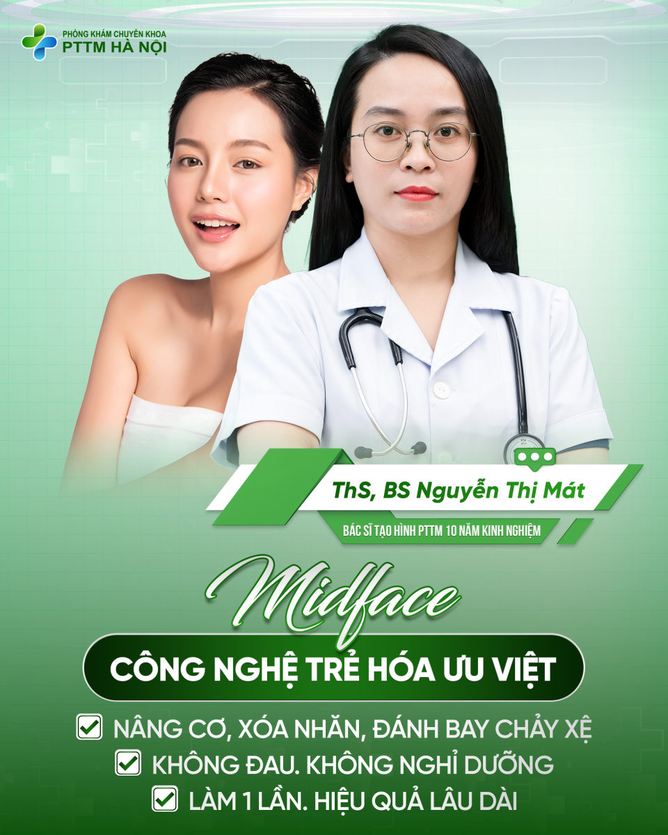 Minh họa chỉnh hình midface với đường nét má rõ, nâng cơ mặt vùng giữa