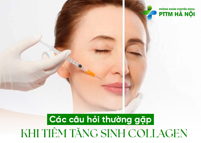 Câu hỏi thường gặp khi tiêm collagen