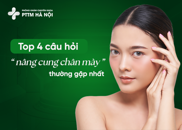 Câu hỏi thường gặp sau treo cung mày