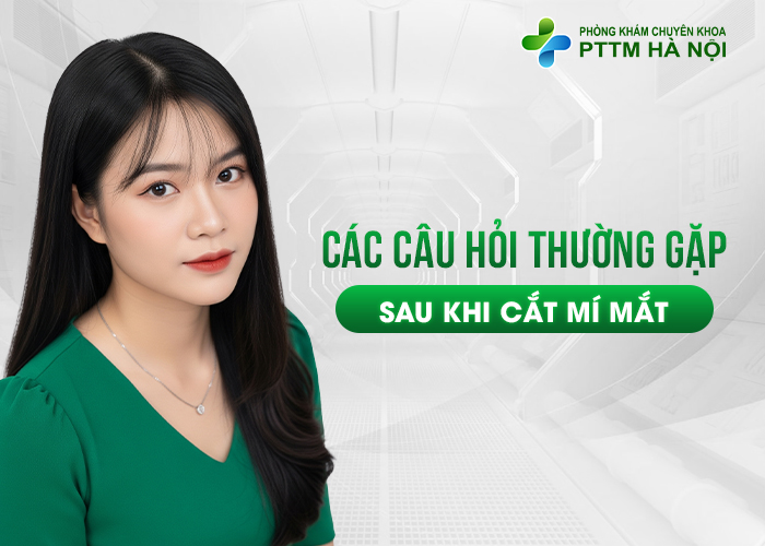 Các câu hỏi thường gặp sau khi cắt mí mắt