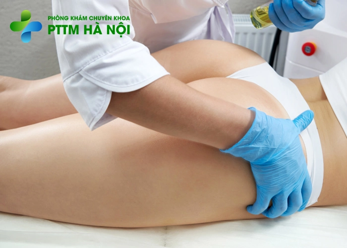Mẫu đang được nâng mông bằng mỡ tự thân tại phòng khám thẩm mỹ