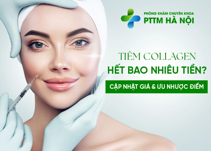 Tiêm collagen hết bao nhiêu tiền? Giá mới nhất và ưu nhược điểm