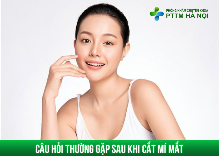Tổng hợp các câu hỏi thường gặp sau khi cắt mí mắt – chăm sóc, kiêng ăn, hồi phục