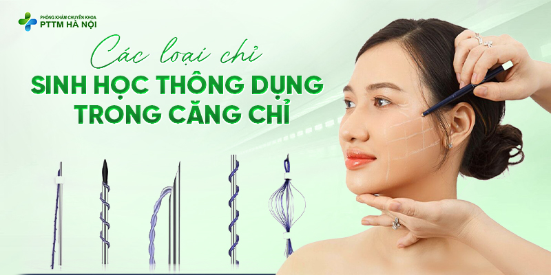 Các loại chỉ căng da mặt sử dụng trong Baby Lift 5D