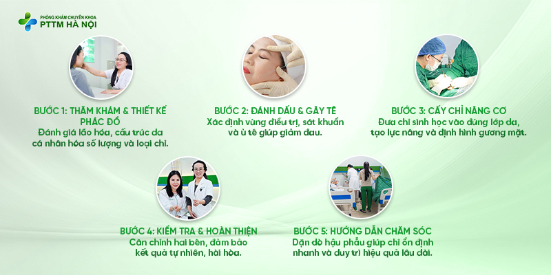 Quy trình căng chỉ da mặt Baby Lift 5D chuẩn y khoa