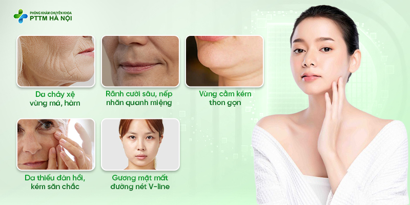 Các tình trạng da cần căng chỉ như chảy xệ nếp nhăn da lão hóa