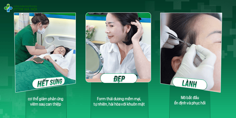 3 giai đoạn phục hồi sau độn thái dương bao gồm hết sưng, đẹp và lành