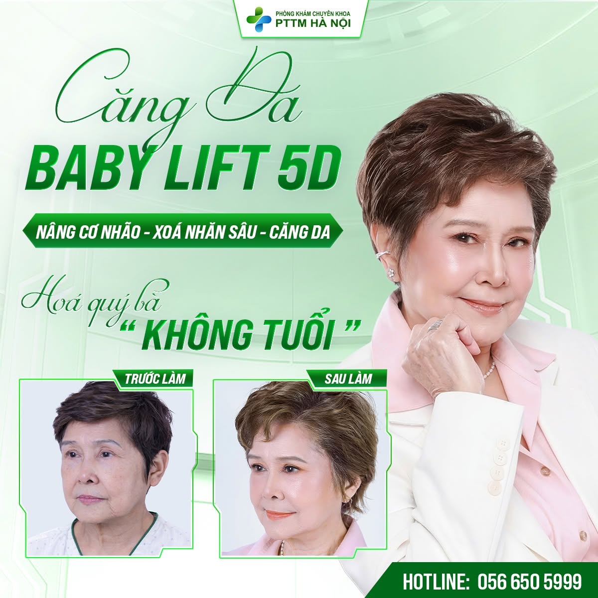 Căng da CORE SMAS LIFT