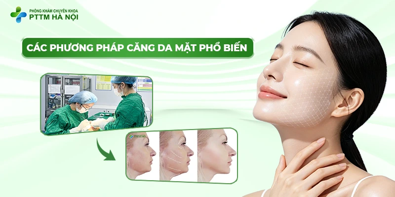 Các phương pháp căng da mặt phổ biến quyết định phẫu thuật căng da mặt được bao lâu.