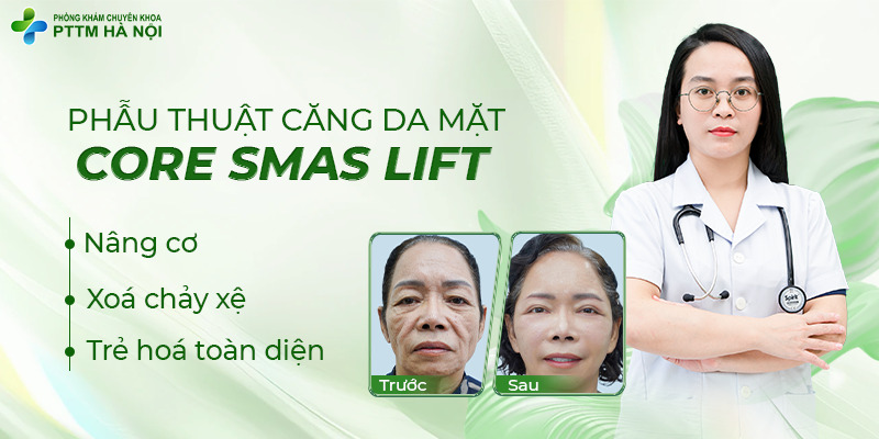 Giới thiệu công nghệ phẫu thuật căng da mặt Core SMAS Lift giúp nâng cơ và trẻ hóa.